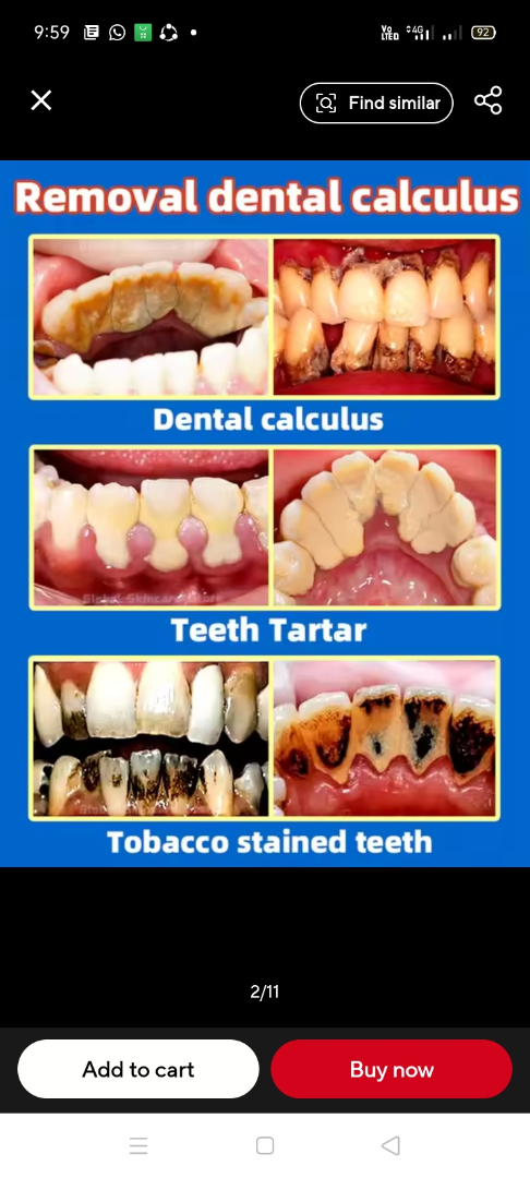 Ayuda a cada sueño de tener dientes sanos ✨63492465564035124