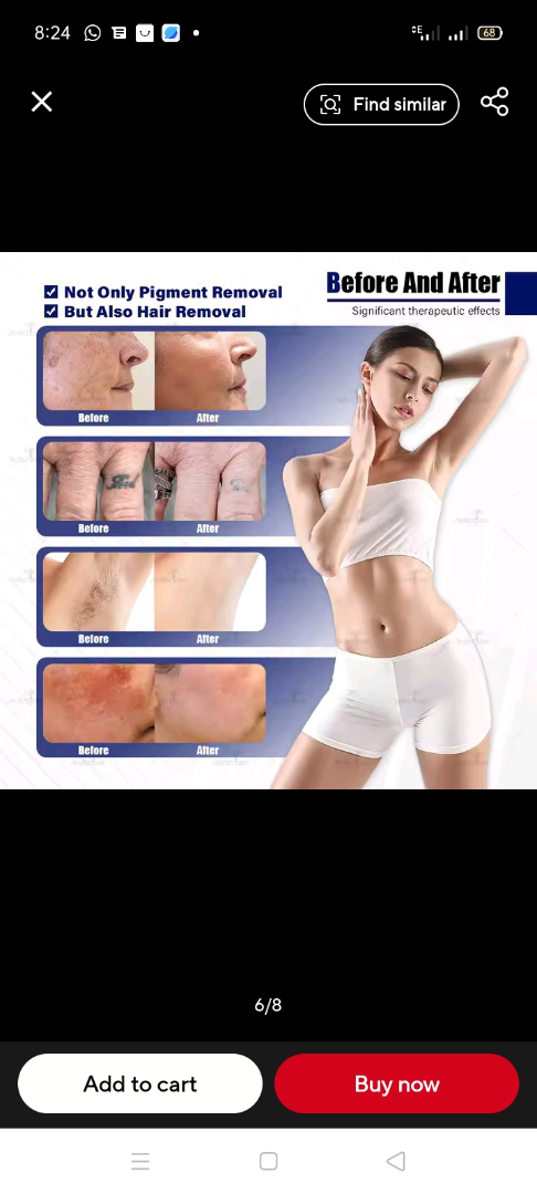 Newest Picosecond Tattoo Removal Machine 4Waves Pico Q-Switch Nd Yag Pigmentation Carbon ✓63468093921283120